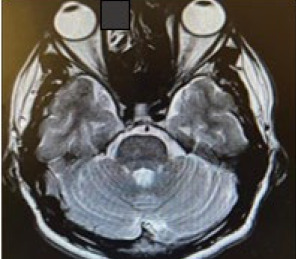 Figure 2B