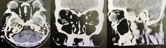 Figure 3B