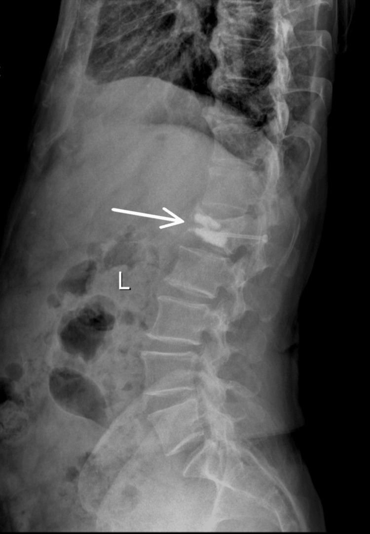 Figure 6