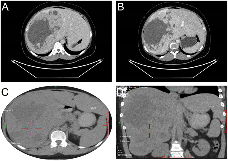 Figure 1
