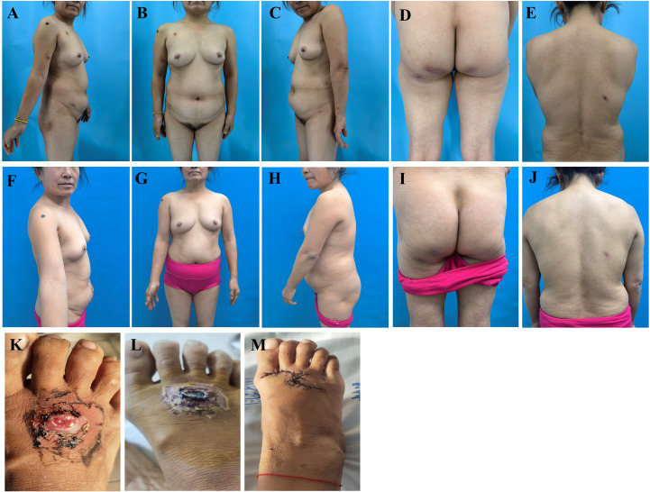 Figure 1