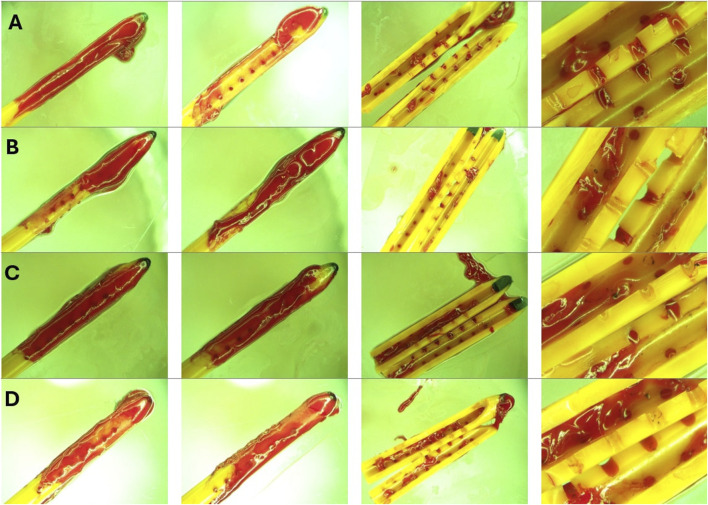 FIGURE 11