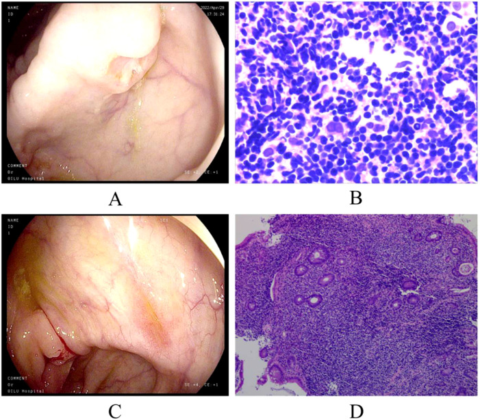Figure 1