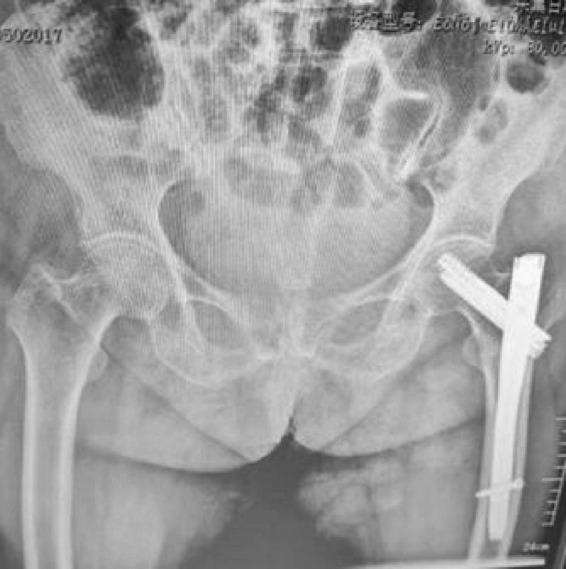 FIGURE 6
