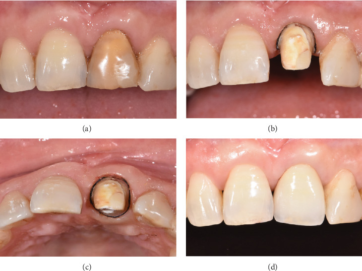 Figure 4