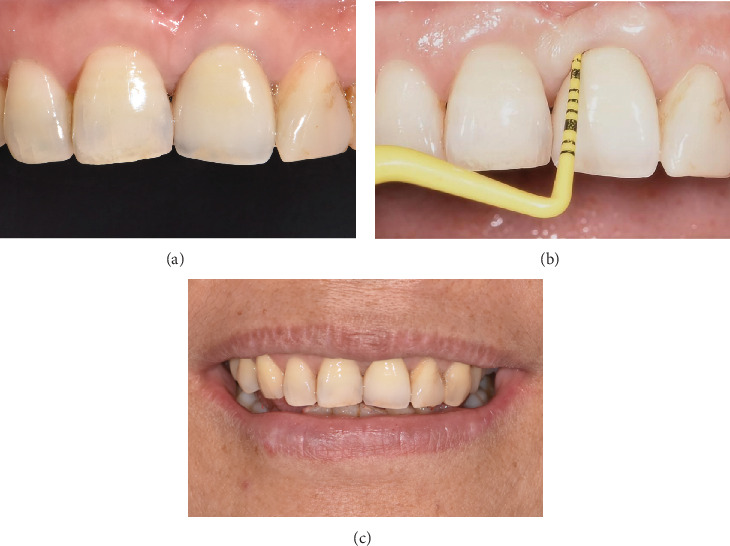 Figure 5