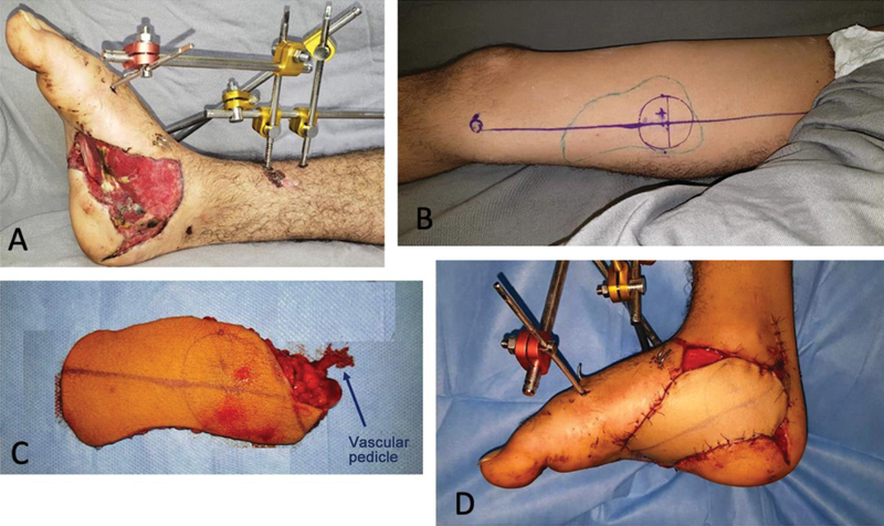 Fig. 7