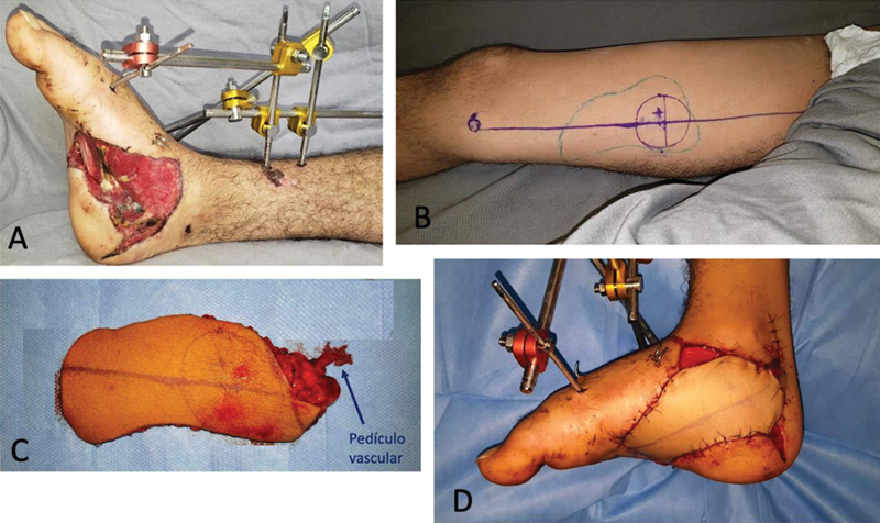 Fig. 7
