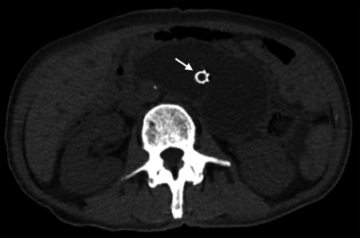 Fig. 1