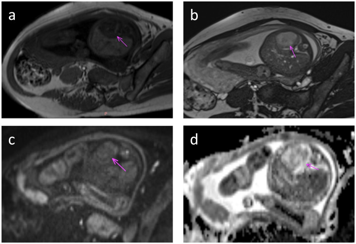 Figure 2
