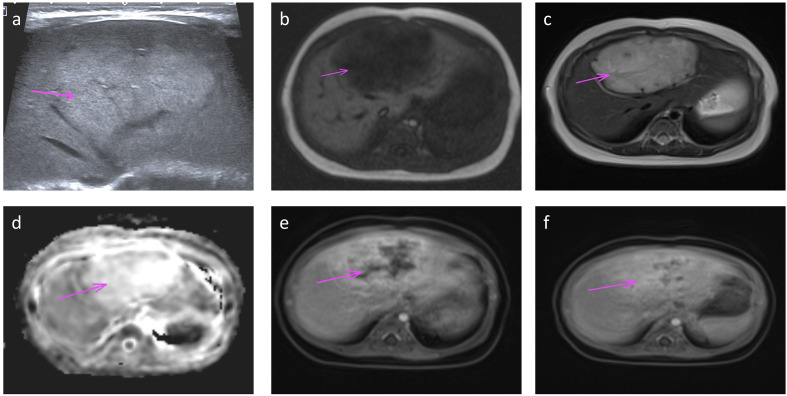 Figure 3