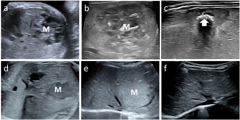 Figure 4