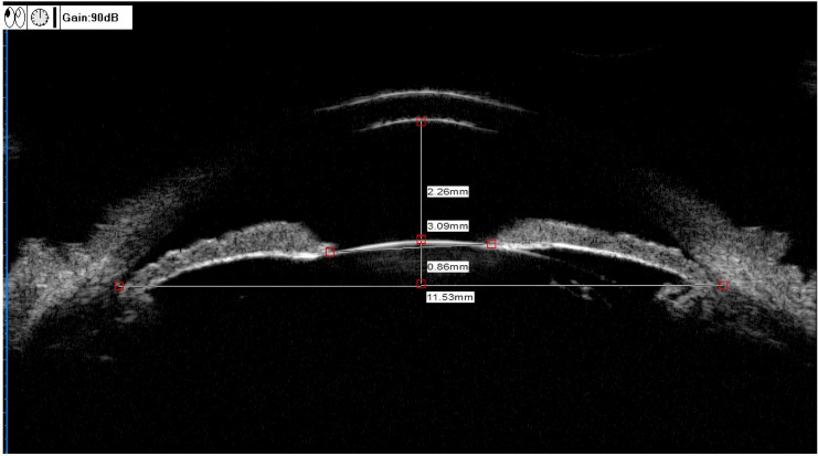 Figure 1