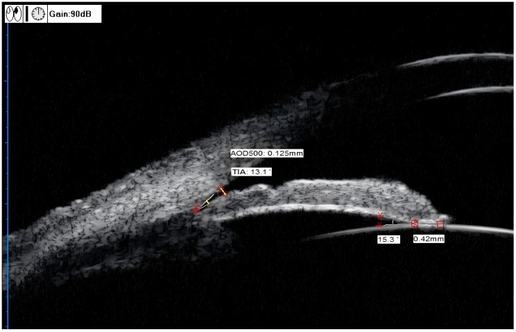 Figure 2