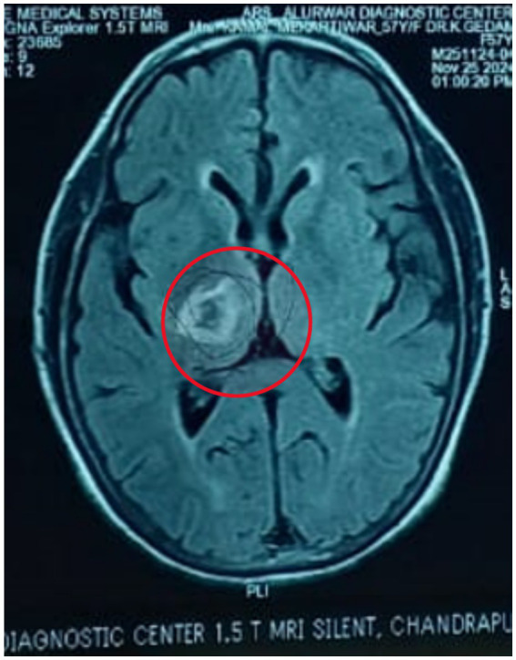 Figure 2