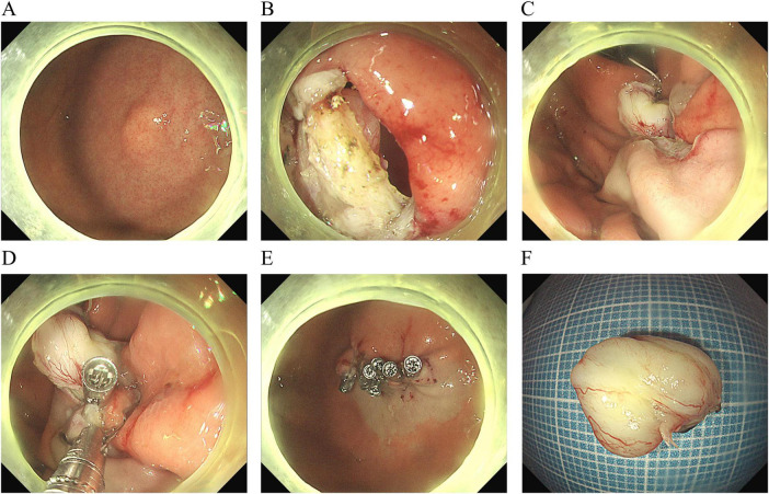 FIGURE 1