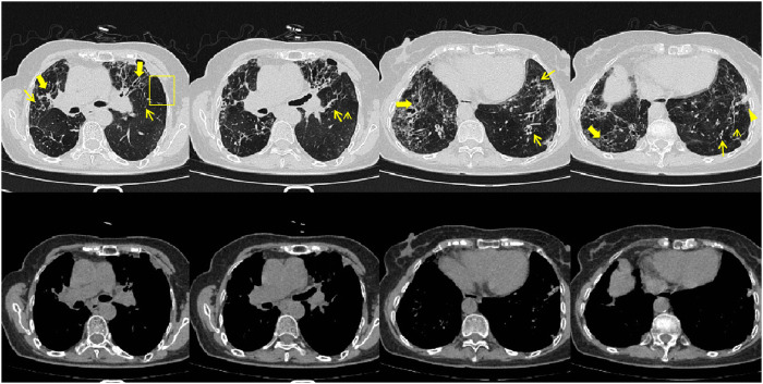 FIGURE 2