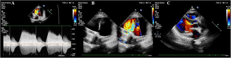Figure 2