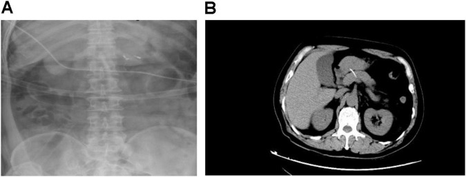 FIGURE 1