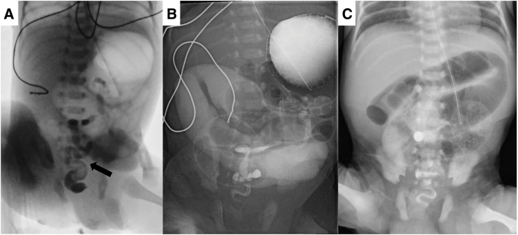 Fig. 1