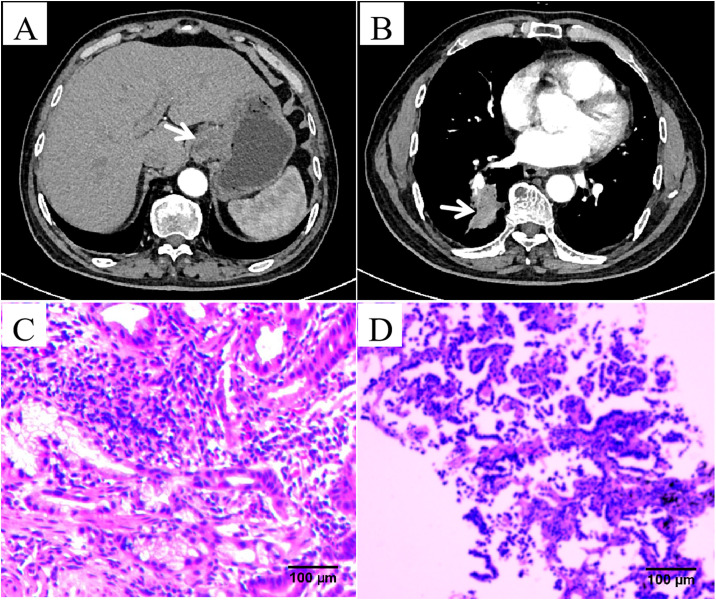Figure 1
