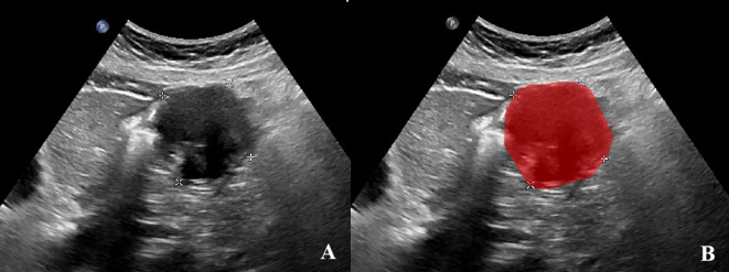 Figure 2