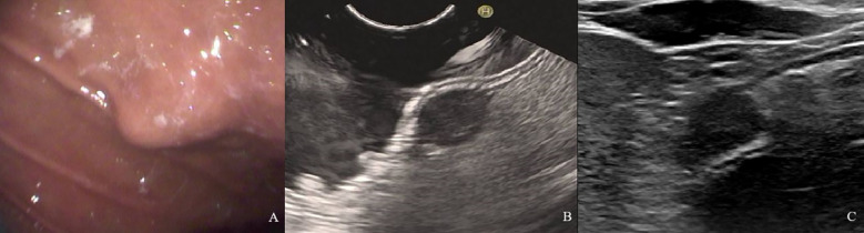 Figure 4