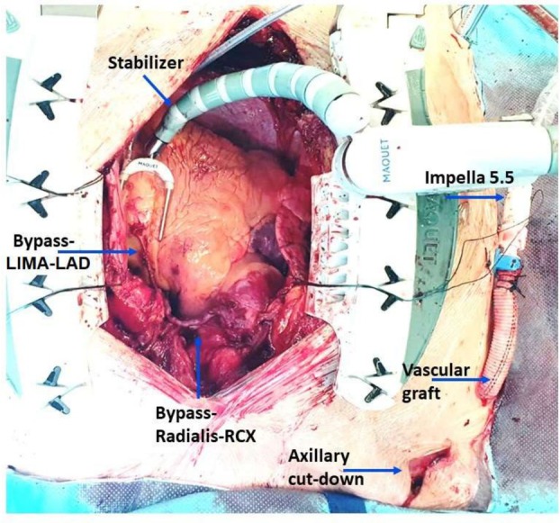FIGURE 1