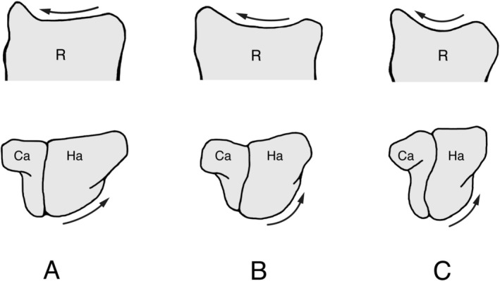 FIGURE 2