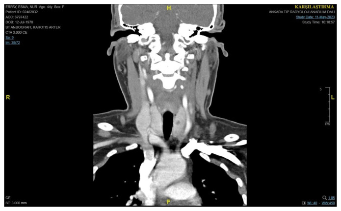 Figure 5
