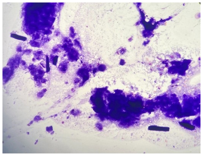 Figure 6