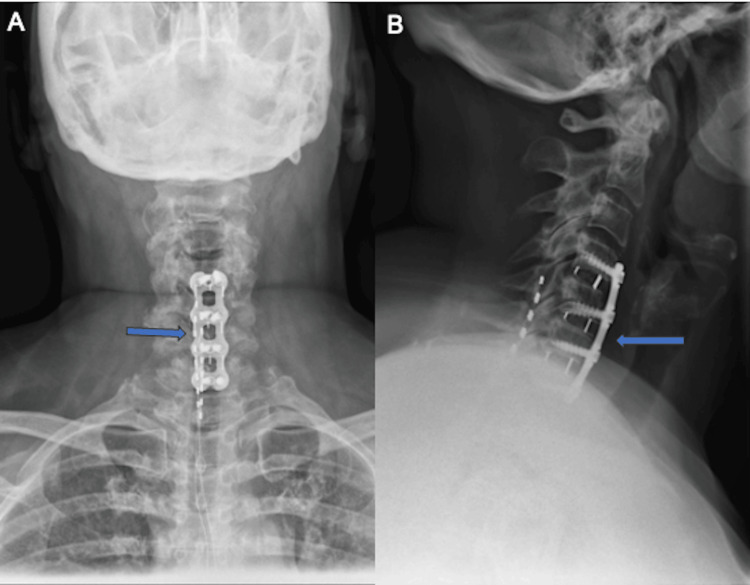 Figure 5
