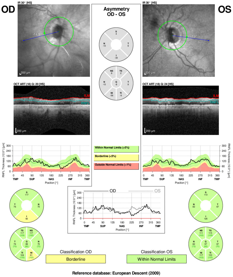 Figure 2