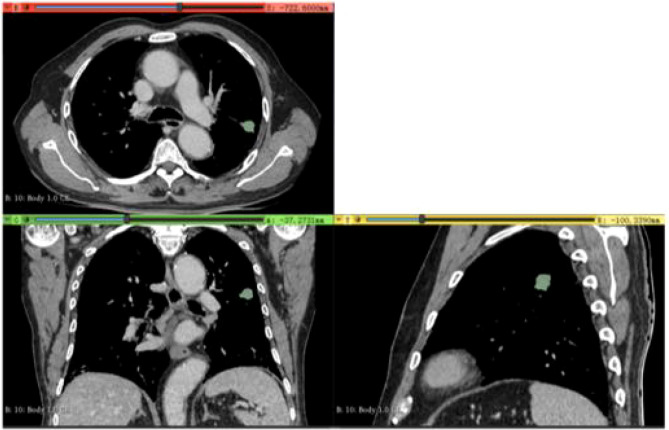 Figure 3