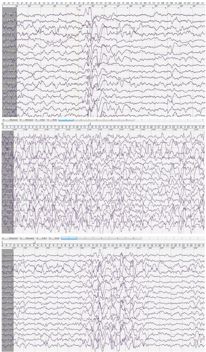 FIGURE 1
