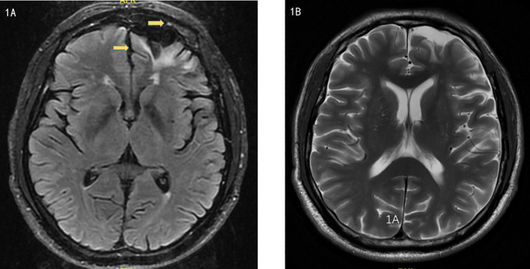 Figure 1