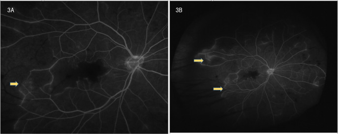 Figure 3