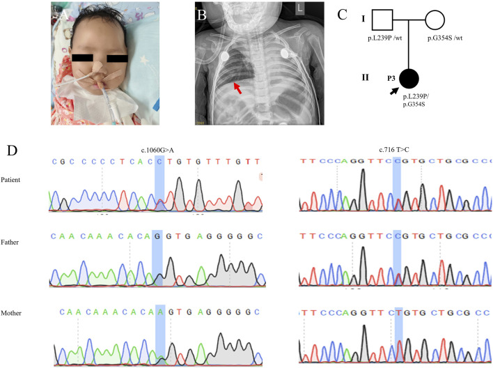 FIGURE 3
