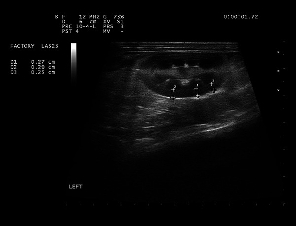 FIGURE 1