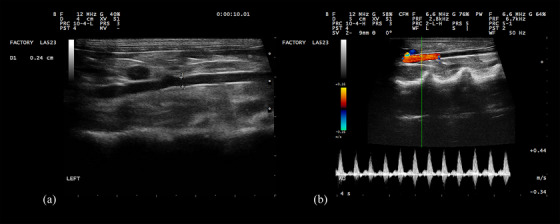 FIGURE 2