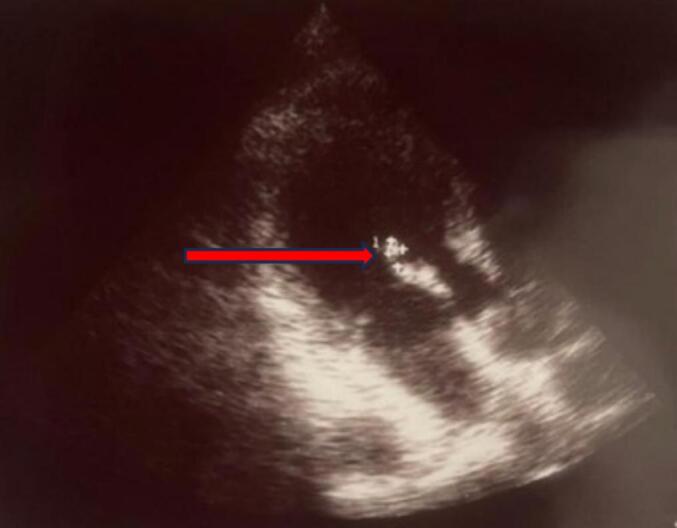 Figure 6