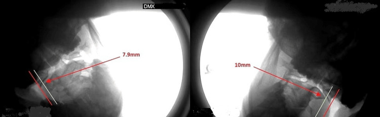Figure 12