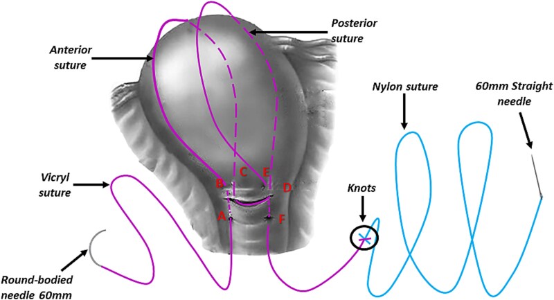 Figure 5