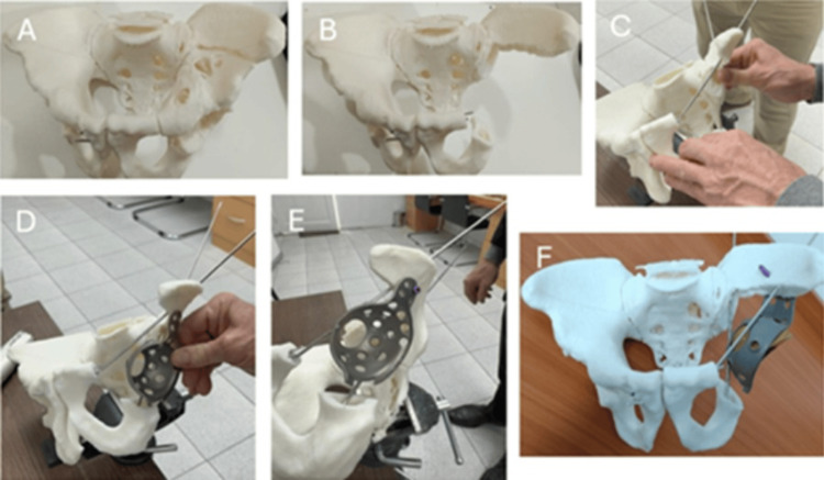 Figure 4