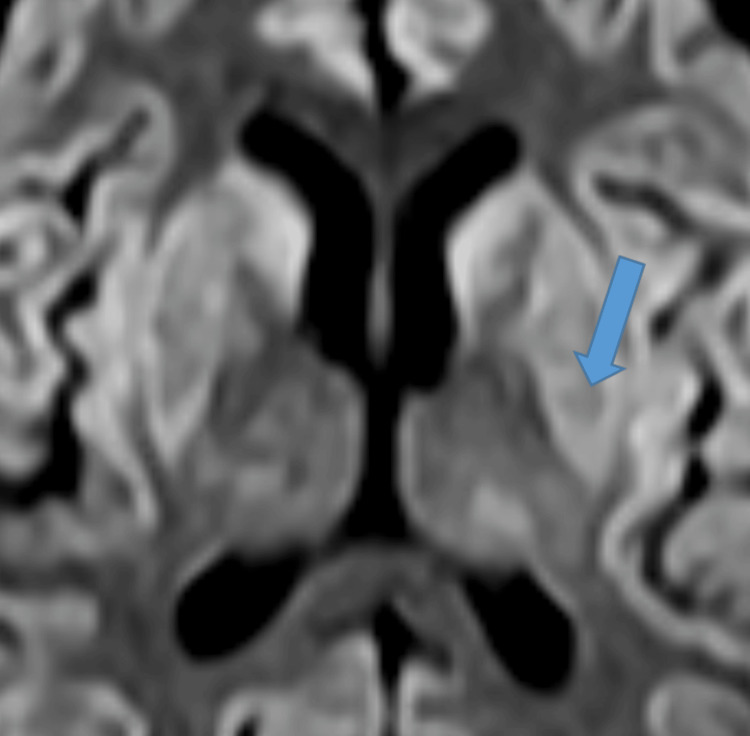 Figure 5