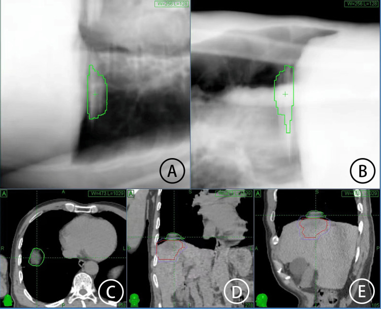 Figure 2