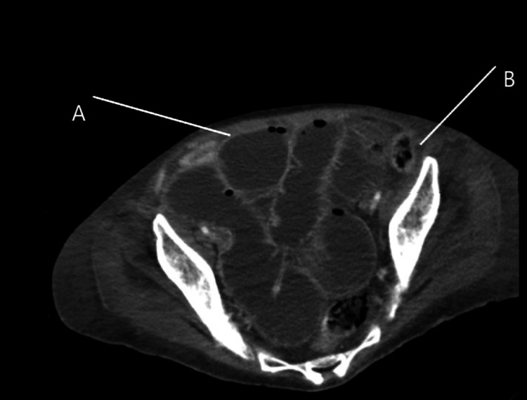 Figure 5