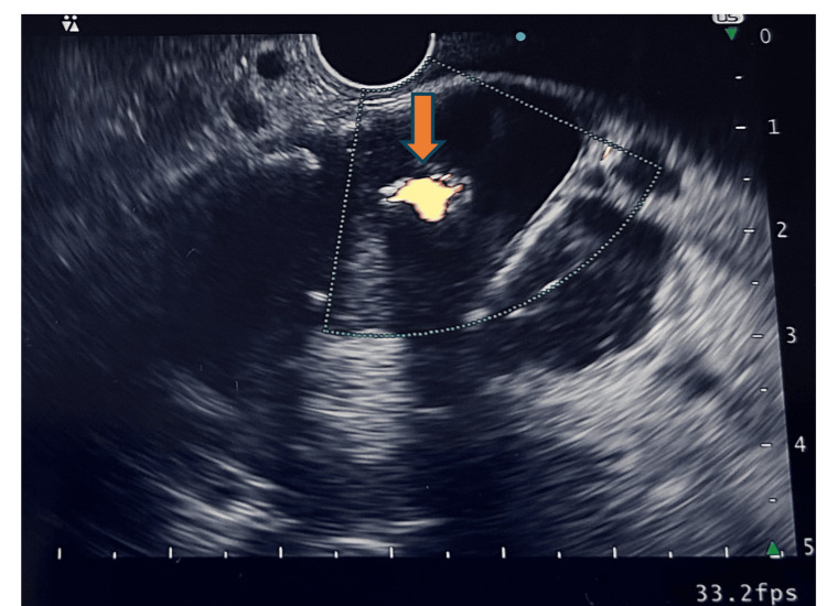 Figure 8
