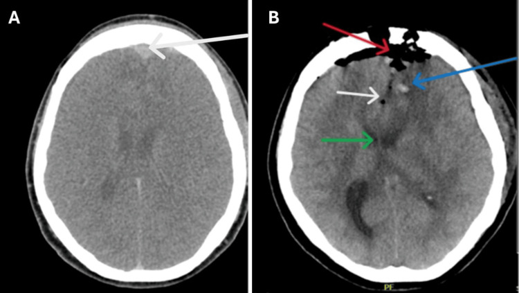 Figure 6