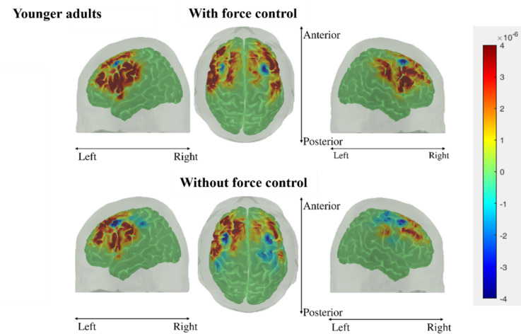 Figure 11